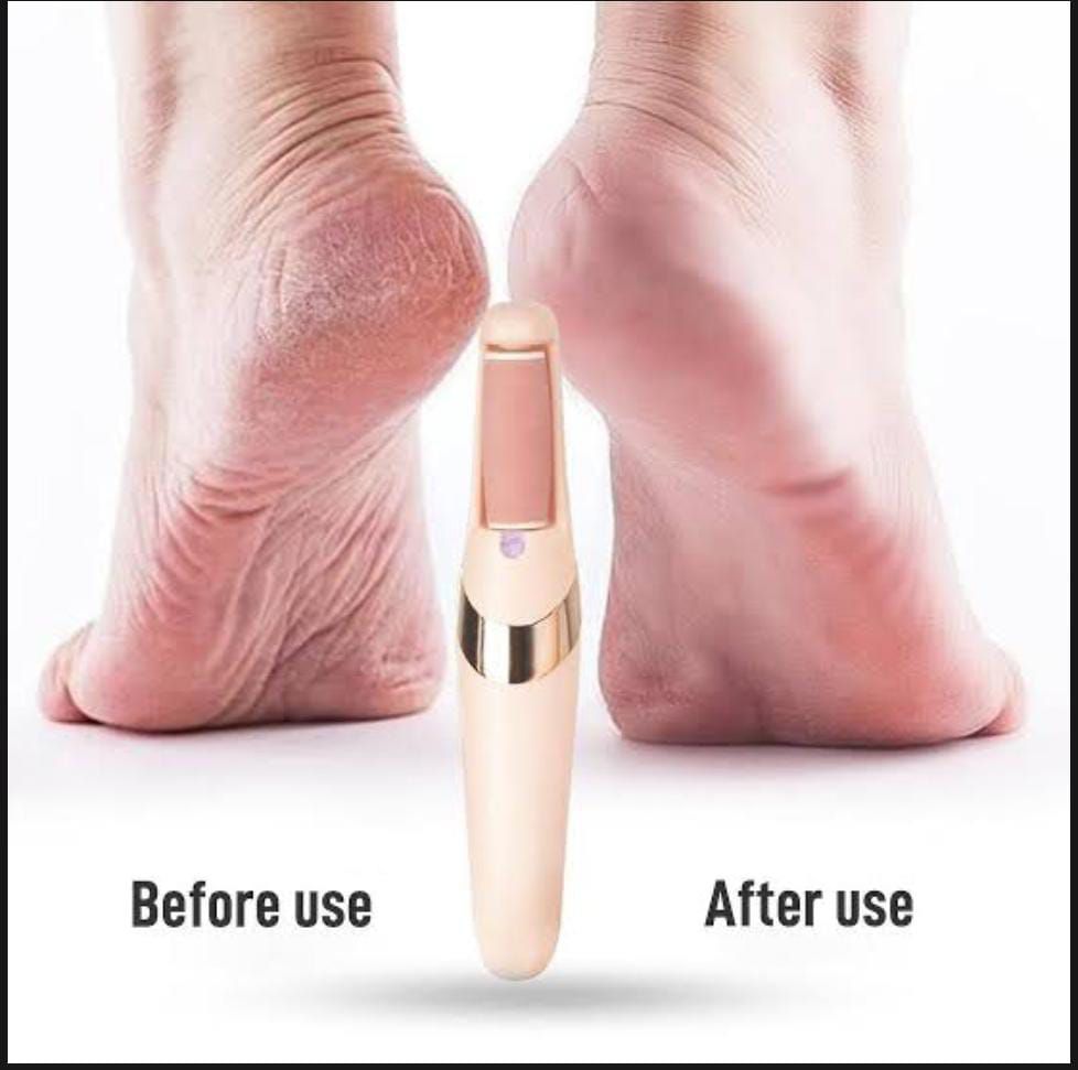 Rechargeable Electric Pedi Foot Filer Effective Callus Remover For Soft Smooth Feet With Easy Use And Reliable Performance